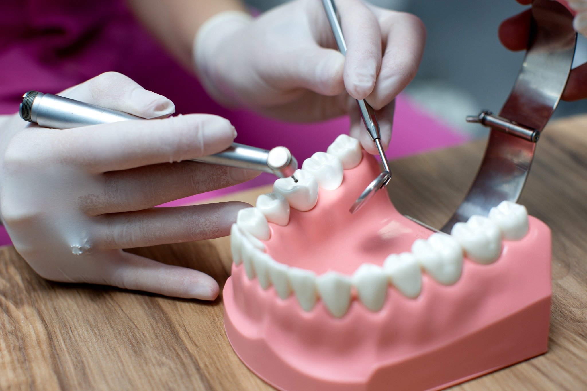 Composite Bonding